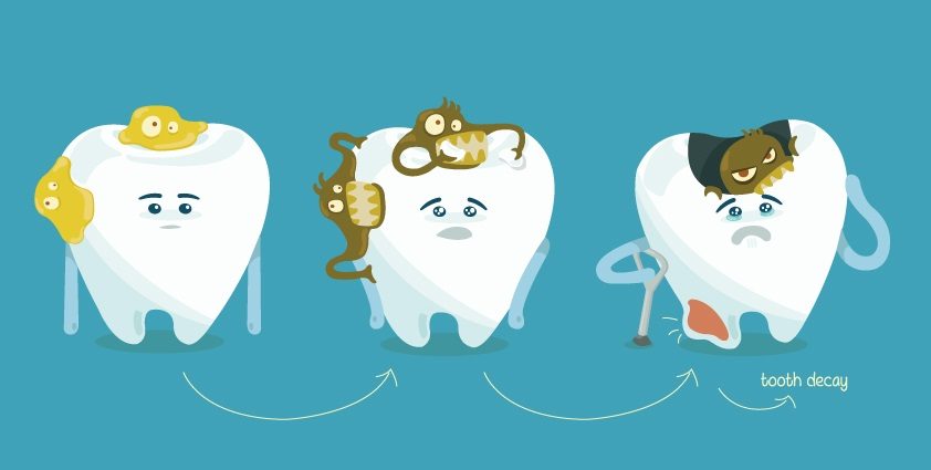 process of tooth decay